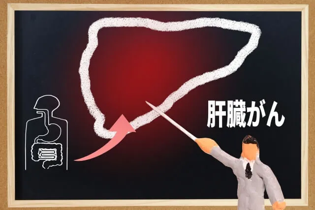 人体図に大きな肝臓が描かれた看板を、粘土人形が指揮棒で指しているイラスト。隣に『肝臓がん』と書かれている。