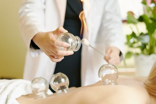 白衣を着た先生がカッピング療法の準備として吸い玉と火のついためん棒を手に持つ