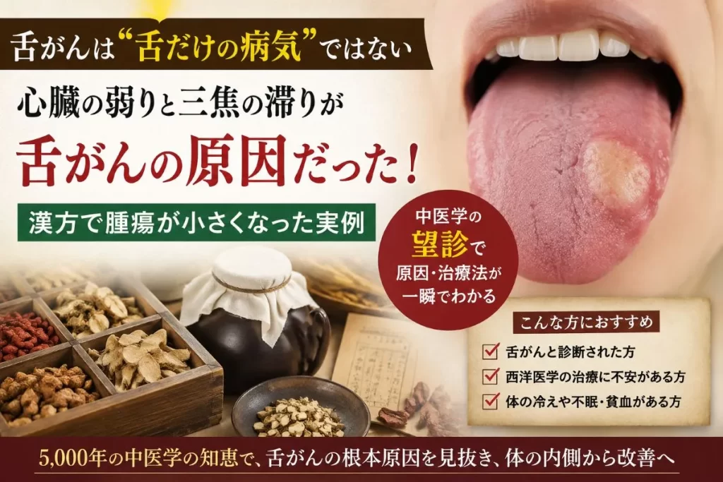 中医学の望診で舌がんの原因を判断し、漢方治療で腫瘍が改善した症例のイメージ