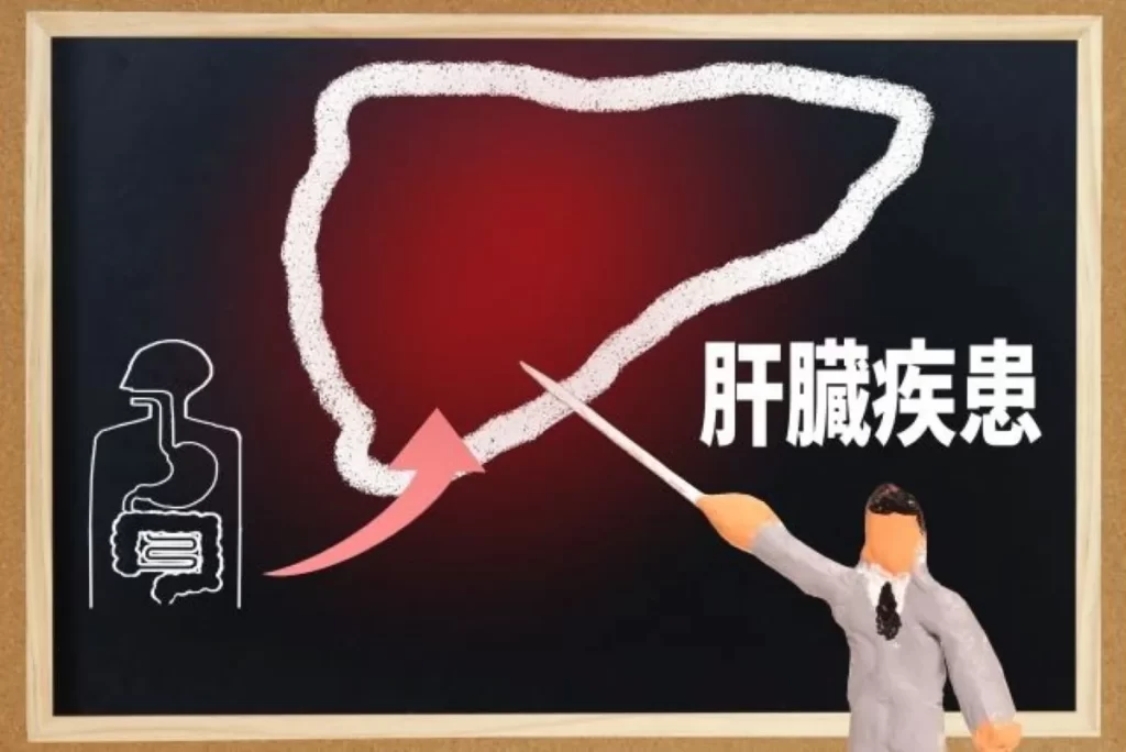 肝臓疾患のイラストを指し示す粘土人形と黒板の図解