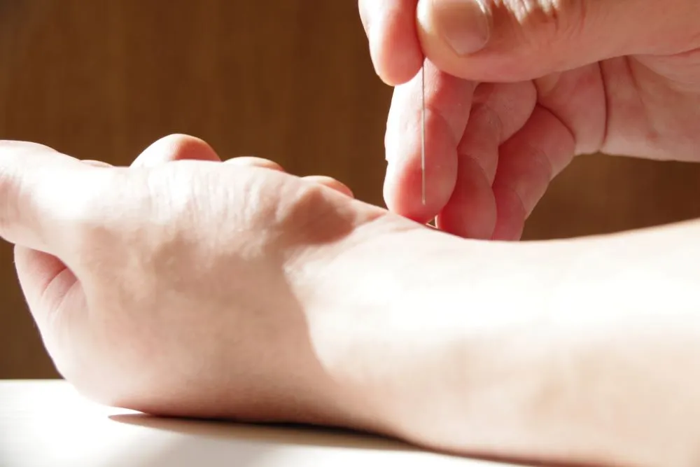 鍼灸師が右手に鍼を持ち、左手首の内側に鍼を刺す準備をする様子