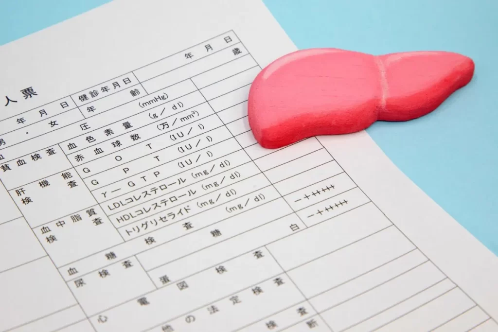 肝硬変 腹水 診断書と肝臓模型イラスト