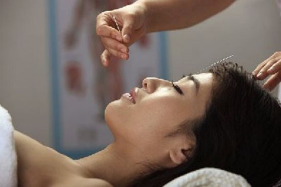 仰向けの女性の顔に美容鍼を施術する鍼灸師の手