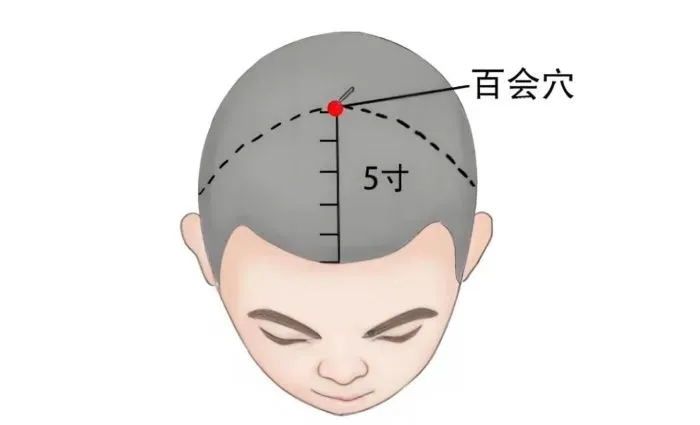 頭頂部の百会穴の位置を示したイラスト