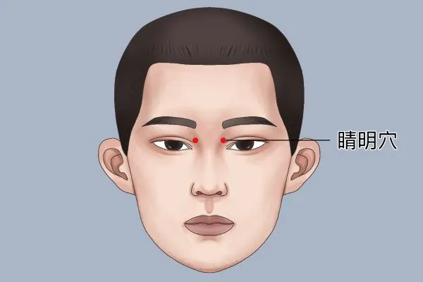晴明穴の位置を示す簡易イラスト。目の内側に位置する視力トラブルに効果的な鍼治療のツボ。
