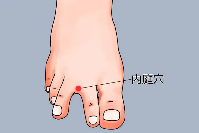 足の甲にある内廷穴（内庭穴）の位置を赤丸で示したイラスト。中国語表記。花粉症による右鼻づまりの治療で左の内廷穴を使用。