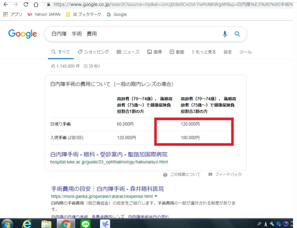 白内障手術費用のGoogle検索結果スクリーンショット：高額な費用表示例