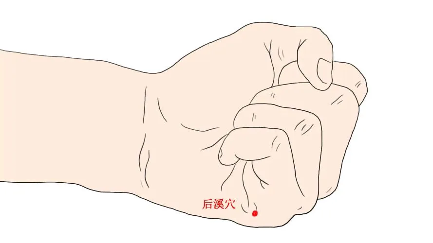 後渓穴（小指の付け根・握り拳にしたときにできる横ジワの端）の手書きイラスト