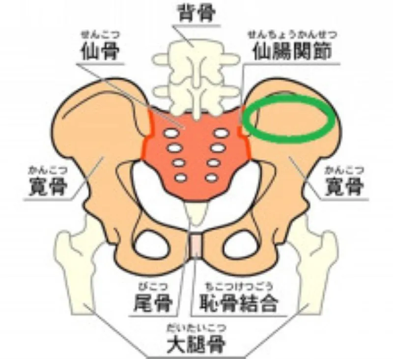 骨盤の寛骨と仙腸関節の図。緑の楕円で示した部分が痛む場所を表している。一般的な坐骨神経痛とは異なる痛みの位置。
