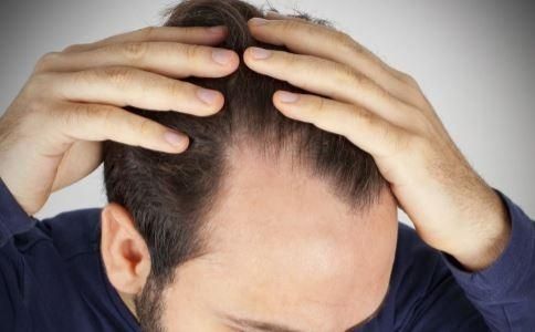 頭皮のフケとかゆみが気になり両手で髪を観察する男性