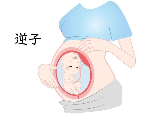 お母さんのお腹にいる逆子の赤ちゃんのイラスト - 鍼2回で改善