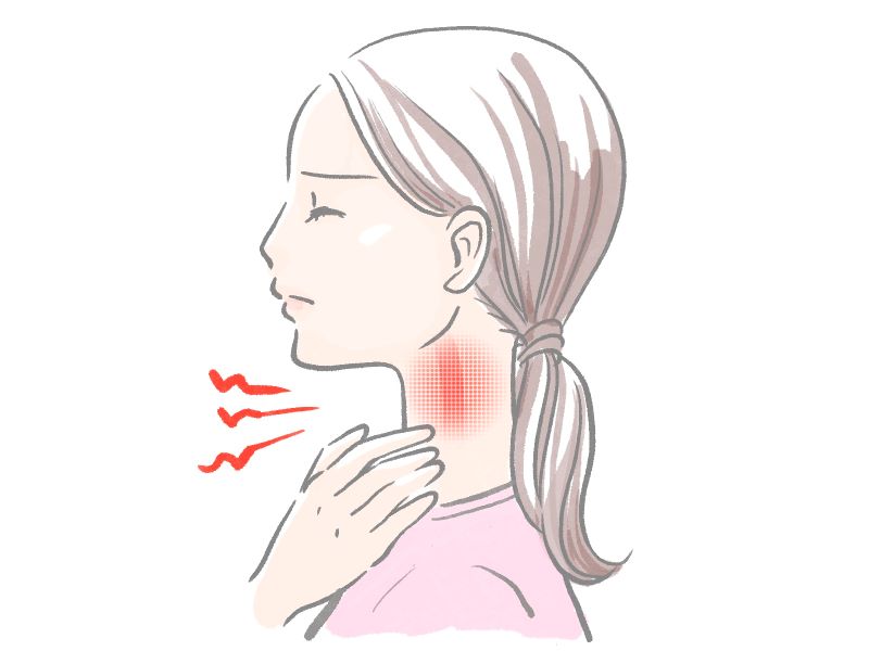 飲み込むのも大変な喉の痛み、鍼4回で完治
