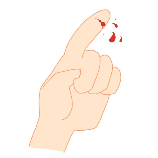 指を切って血が噴水みたいに出た婦人、漢方薬粉で止血し傷口も短期間できれいに治った例。