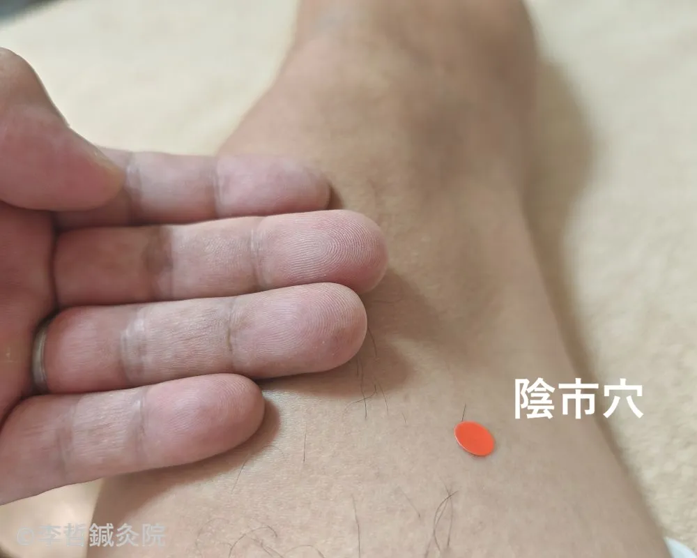 右膝上の陰市穴に赤丸シールを貼り、白文字でツボ名を表記した位置解説画像。