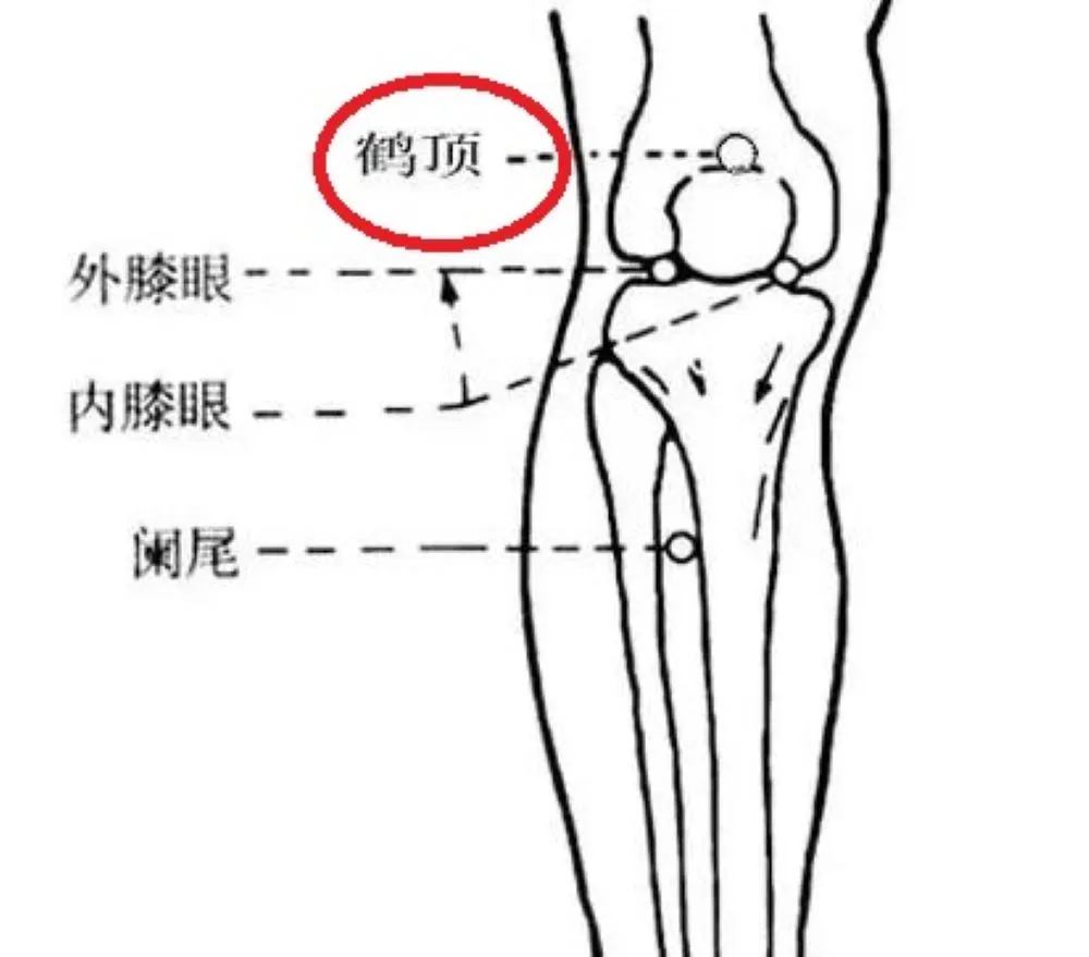 膝の構造とツボ「鶴頂」「外膝眼」「内膝眼」「闌尾」の位置を示したイラスト。鶴頂が赤丸で強調されている。