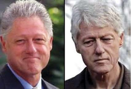 クリントン元大統領の過去と現在の顔写真：陰虚証改善後の変化