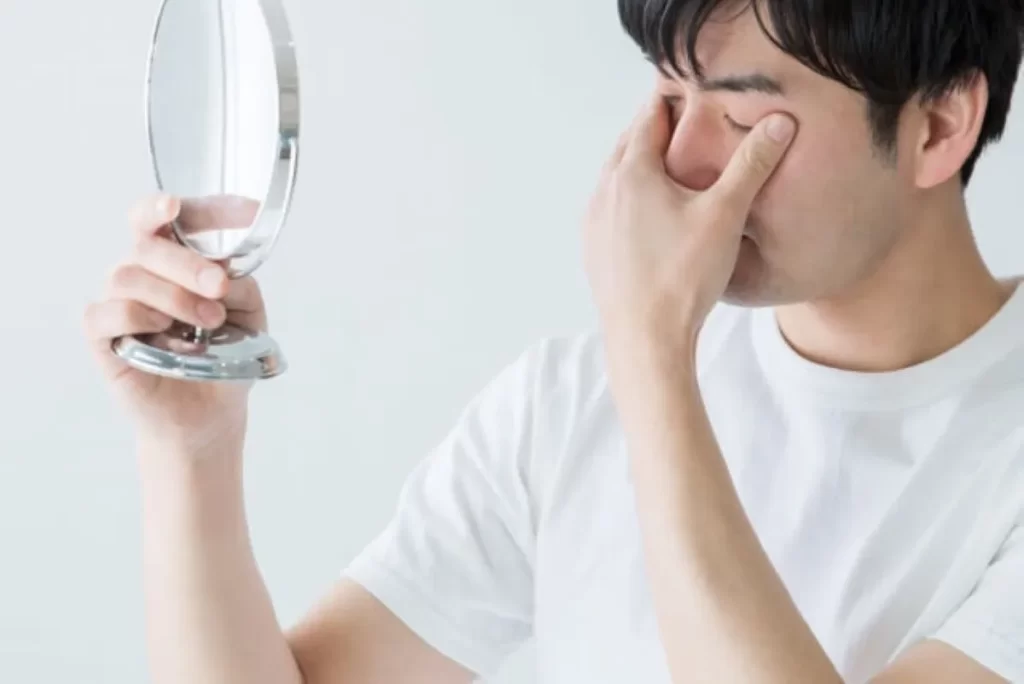 白い半袖を着た男性が鏡で目のかゆみを確認している様子。花粉症の症状を鍼灸治療で改善可能。