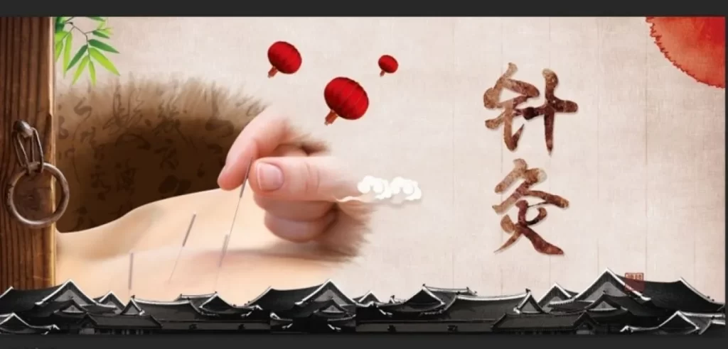 古典的な建築と鍵、鍼を打つ手、提灯、そして「針灸」の文字が描かれた中医学を象徴するイラスト