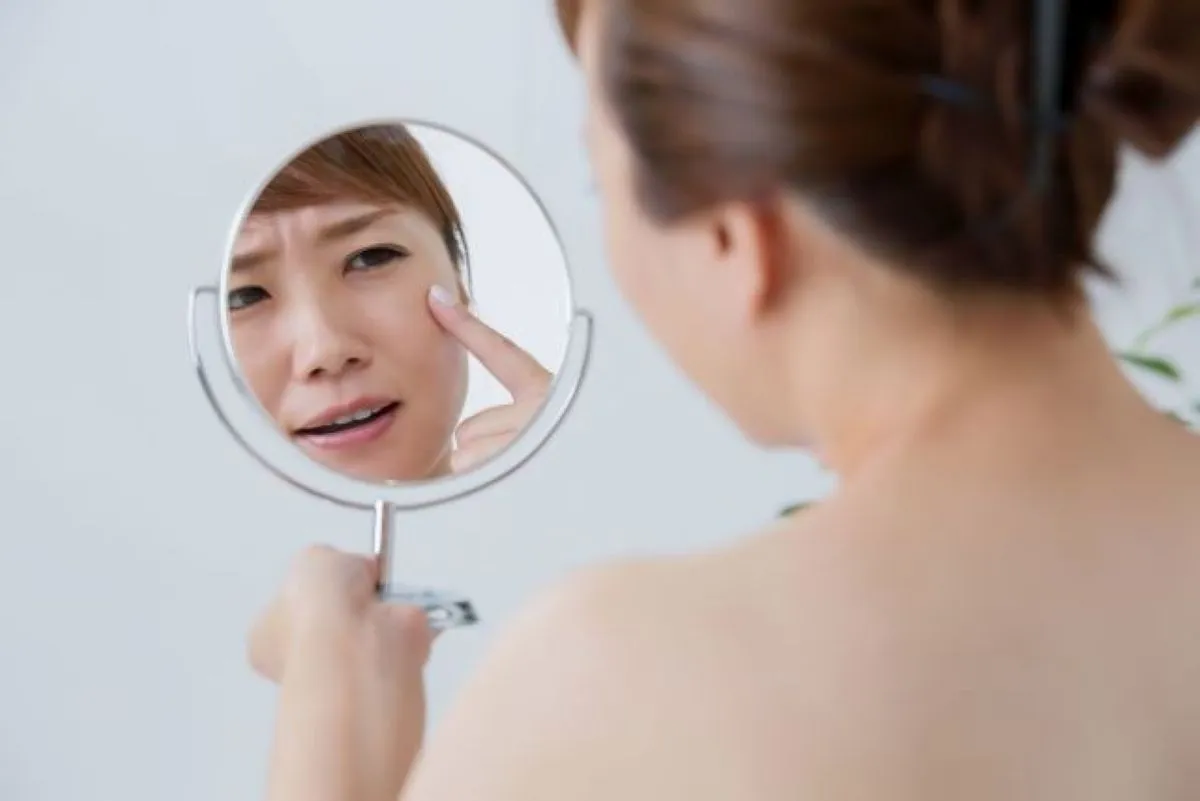 50代女性が鏡を見ながら顔のかぶれ(右ほっぺ)を指差している様子|鍼灸で数回の治療で改善した肌荒れ症例