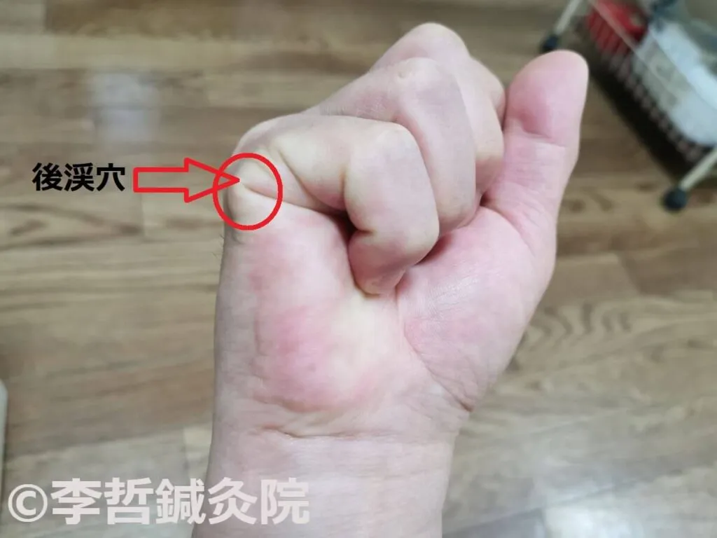 拳を握った右手の小指側にある後渓穴を赤丸と矢印で示した画像