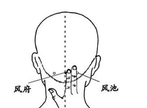 頭の後ろ側に風府（风府）と風池（风池）のツボを中国語で表記した手書き風イラスト