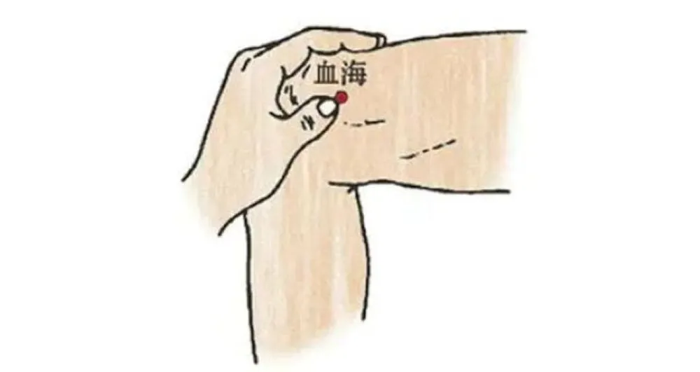 日光じんましん治療に効果的な血海穴（けっかい）の位置イラスト。右膝内側に親指を当てた位置を赤丸で表示