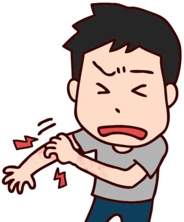 蕁麻疹で腕を激しく掻いている若い男性の漫画イラスト、痒みで眠れない様子