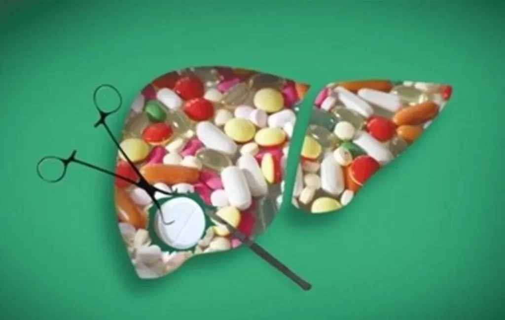 肝臓模型の中に大量の薬が詰まり、ピンセットで錠剤を取り出している様子。薬の負担で弱った肝臓をイメージした写真