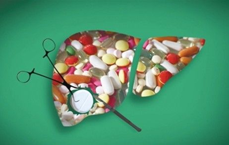 中医学で解毒を促す鍼治療：薬の毒素が詰まった肝臓をイメージしたカラフルなイラスト