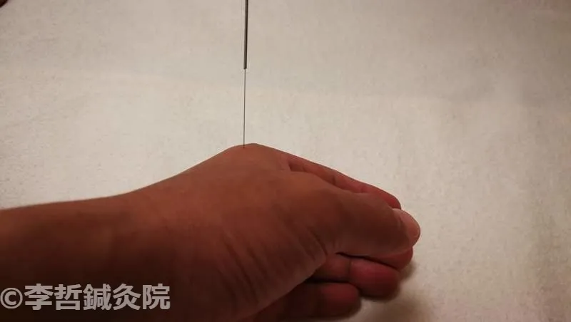 手の甲側に位置する三間穴（大腸経）に鍼を刺したクローズアップ写真。皮膚に細い針が垂直に挿入されている。
