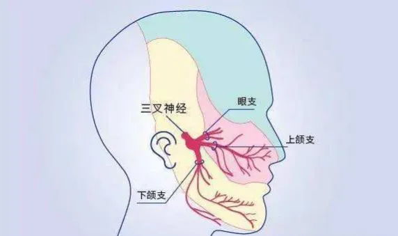 三叉神経の3つの分枝（眼支、上顎支、下顎支）とその分布領域を赤、青、黄の色で区別した顔面イラスト。