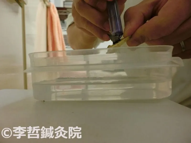 生姜灸で熱くなったもぐさをライターで水入り容器に落とす
