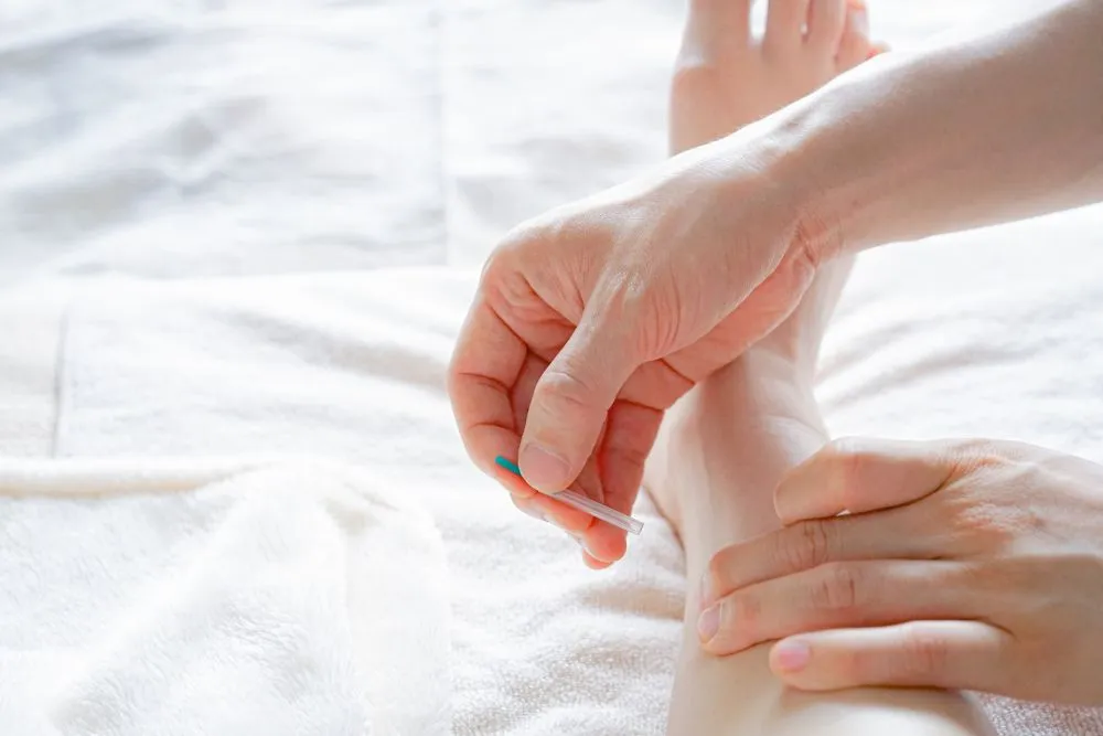 鍼灸師の手元クローズアップ。患者の足の内側に細い鍼を挿入する瞬間、数本の鍼で治療可能なシンプルさを象徴