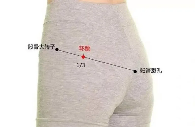 環跳穴（かんちょうけつ）の位置図。お尻の外側、股骨大転子と仙骨裂孔を結ぶ線の3分の1地点に環跳穴を示したイラスト。中国語表記付き