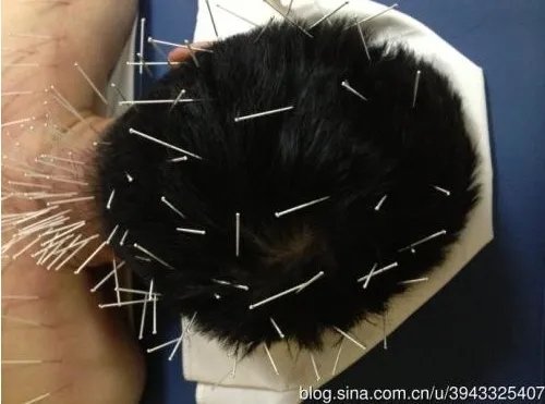 うつ伏せの男性の頭、首、肩に多数の鍼が密集して刺さった鍼灸施術画像