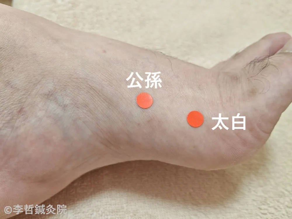 左足の内側にある太白と公孫の位置を赤丸で示したツボ解説画像。脾臓を整え、唇の乾燥や寝相の悪さの改善に使われる代表的なツボ。