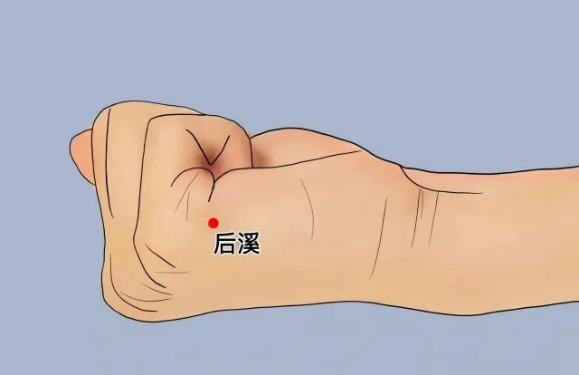 右手の後谿穴（後渓穴）の位置を示したイラスト。赤丸でツボを強調。