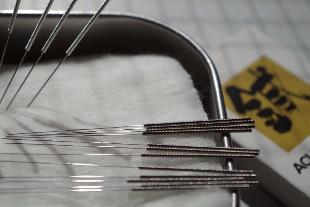 耳中のできものは鍼1回で治った