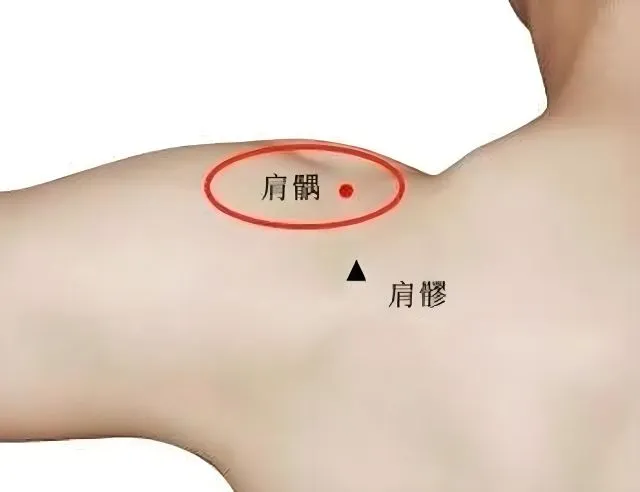 肩髃穴と肩髎穴の位置を示した図。肩を外側に上げた状態で肩髃を赤丸、肩髎を三角でマーク