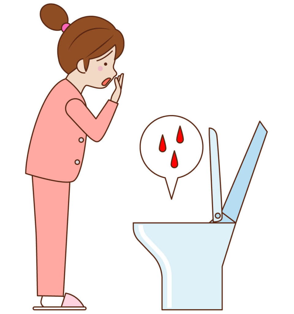 血尿が一晩で収まった例。漢方薬・鍼灸の救急治療も素晴らしい効果がある！