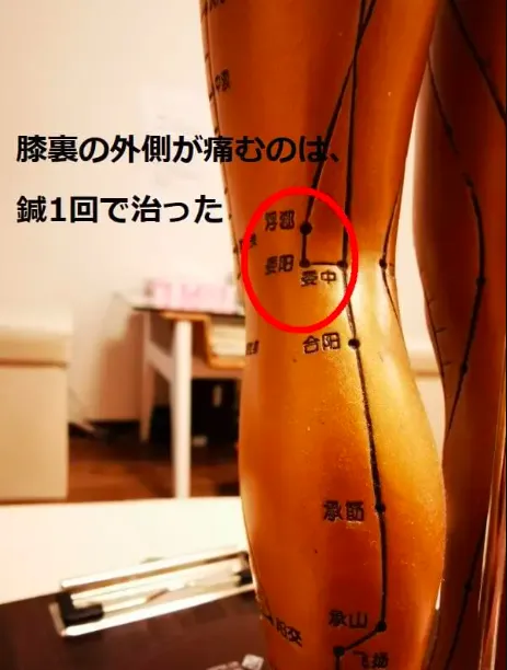 経絡とツボが記された人体模型の膝裏部分をクローズアップした画像。痛みのある場所に赤い丸が描かれ、膀胱経の委陽ツボを示している。