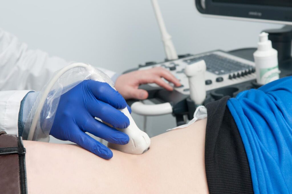 超音波検査では、2㎜以下の胆石が確認できない！