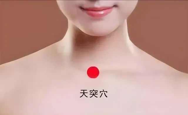 喉の痰に効果的な天突穴（てんとつけつ）の位置を赤丸で示した図。鎖骨のくぼみにあるツボ。