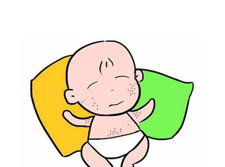 ２歳の赤ちゃん、皮膚が痒いのが１回で緩和。