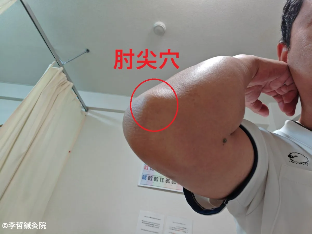 脇の下のコリコリしたしこり（デキモノ）改善におすすめの奇穴「肘尖穴（ちゅうせんけつ）」の位置。肘の尖った骨の先端に赤丸と赤文字で表示。