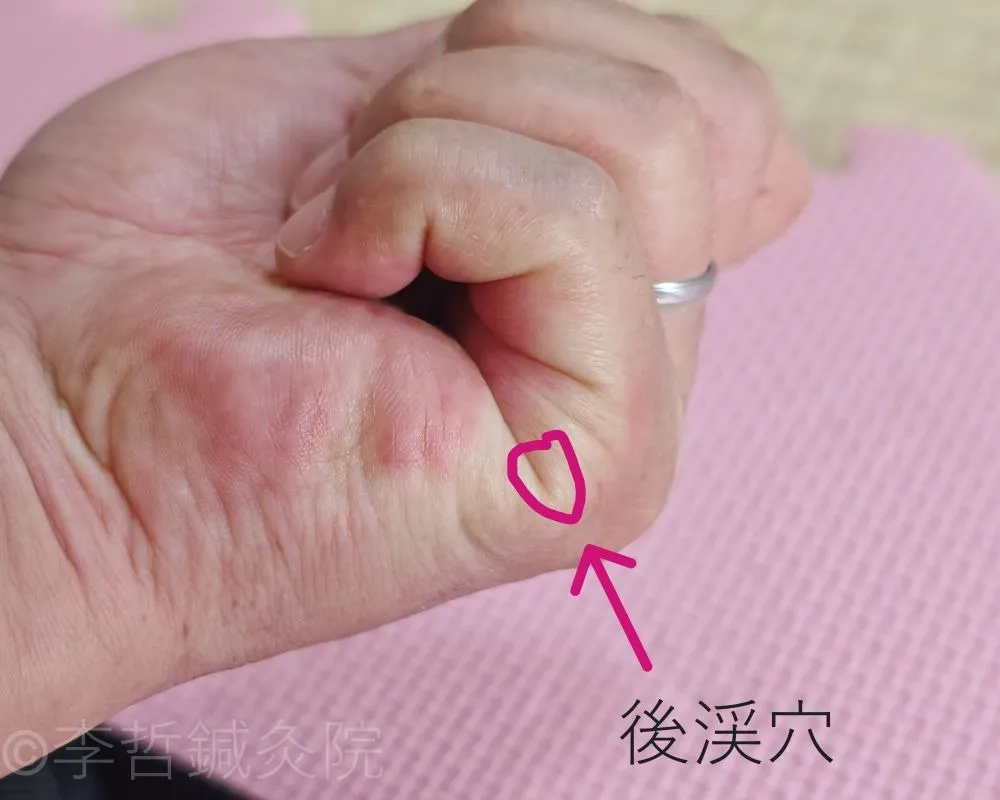左手の側面にある後渓穴の位置を赤丸で示した鍼灸ツボの図