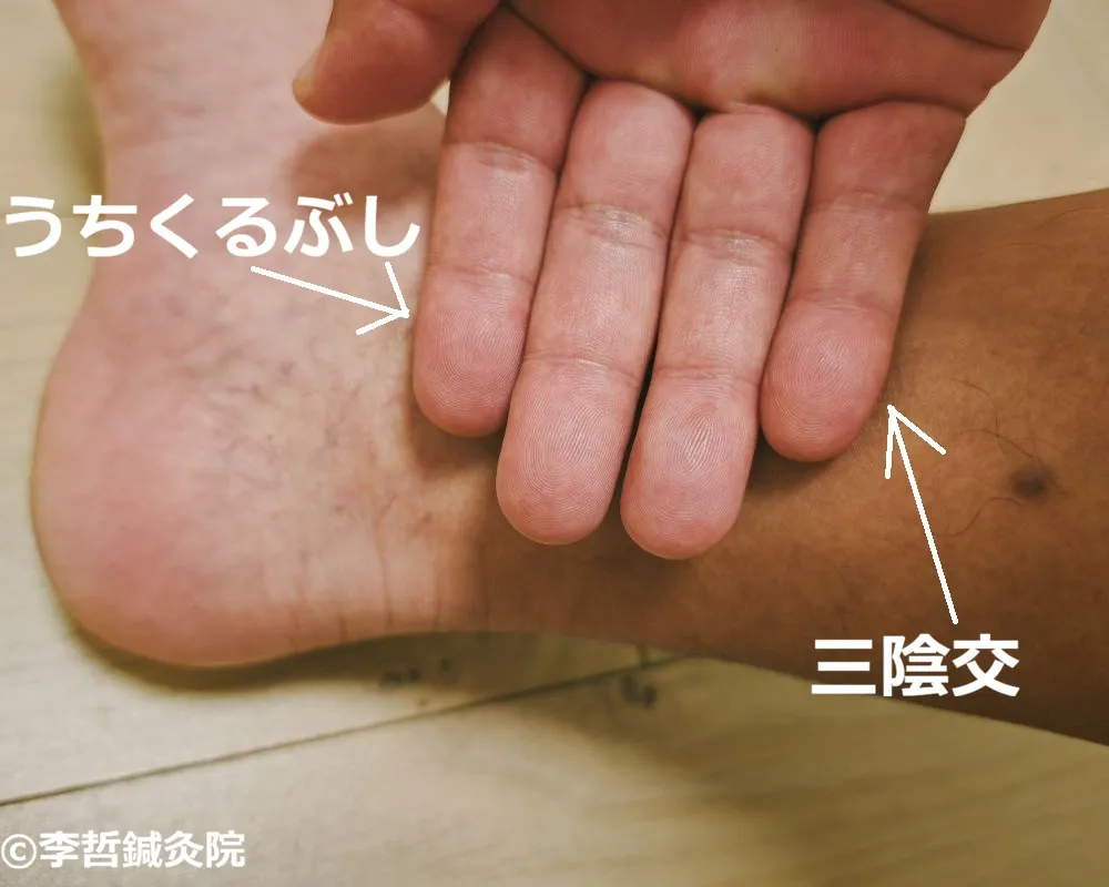内くるぶしの上に指4本を並べ、三陰交の位置を白文字と矢印で示した足の内側の写真。