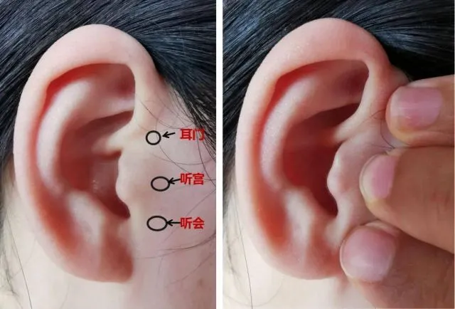 耳の鍼灸ツボ位置図、中国語で耳门・听宫・听会が標記された耳のクローズアップ