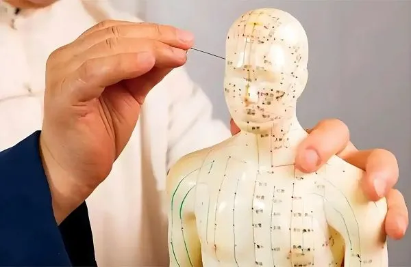 鍼灸師の手がツボ人形に鍼を刺そうとするクローズアップ