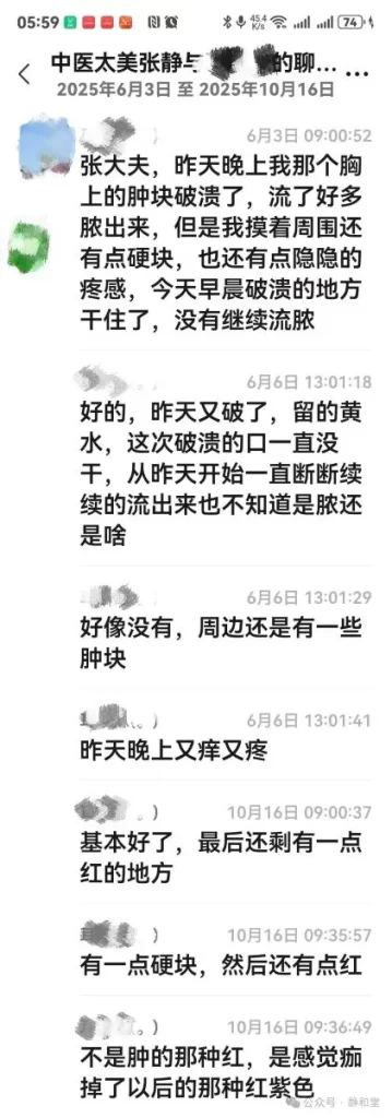 乳腺炎治療中の患者と張静先生のWechatでの経過報告チャット画面のスクリーンショット